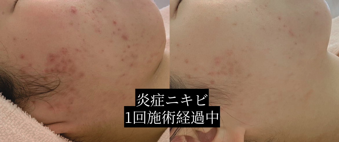 新規タラソトリートメント | BIKAO